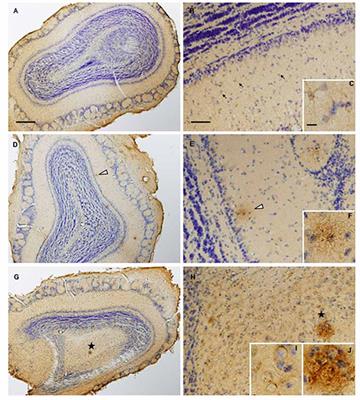 Early-Onset Molecular Derangements in the Olfactory Bulb of Tg2576 Mice: Novel Insights Into the Stress-Responsive Olfactory Kinase Dynamics in Alzheimer’s Disease